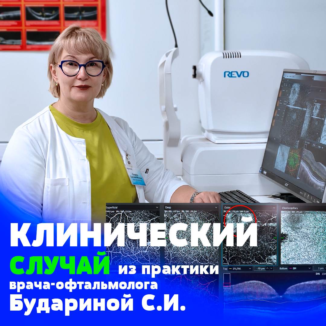 врач-офтальмолог Бударина Светлана Ивановна